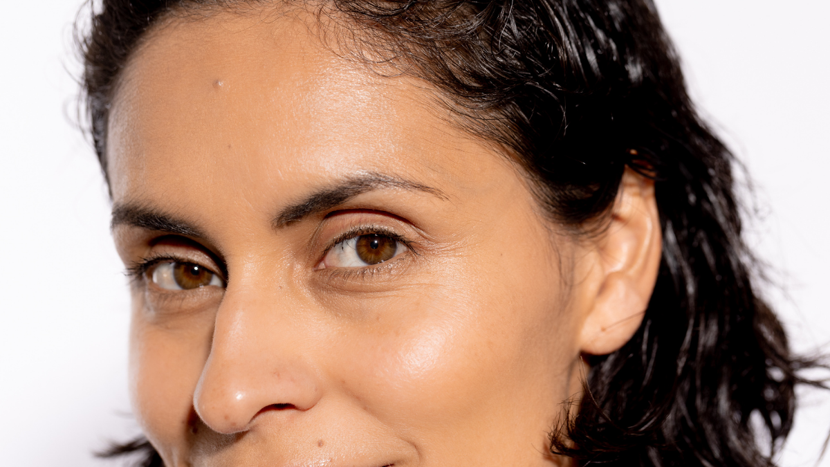 What's causing your breakouts?