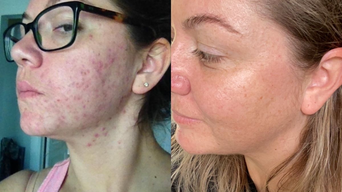 One of Our Own: Amber's Before & After