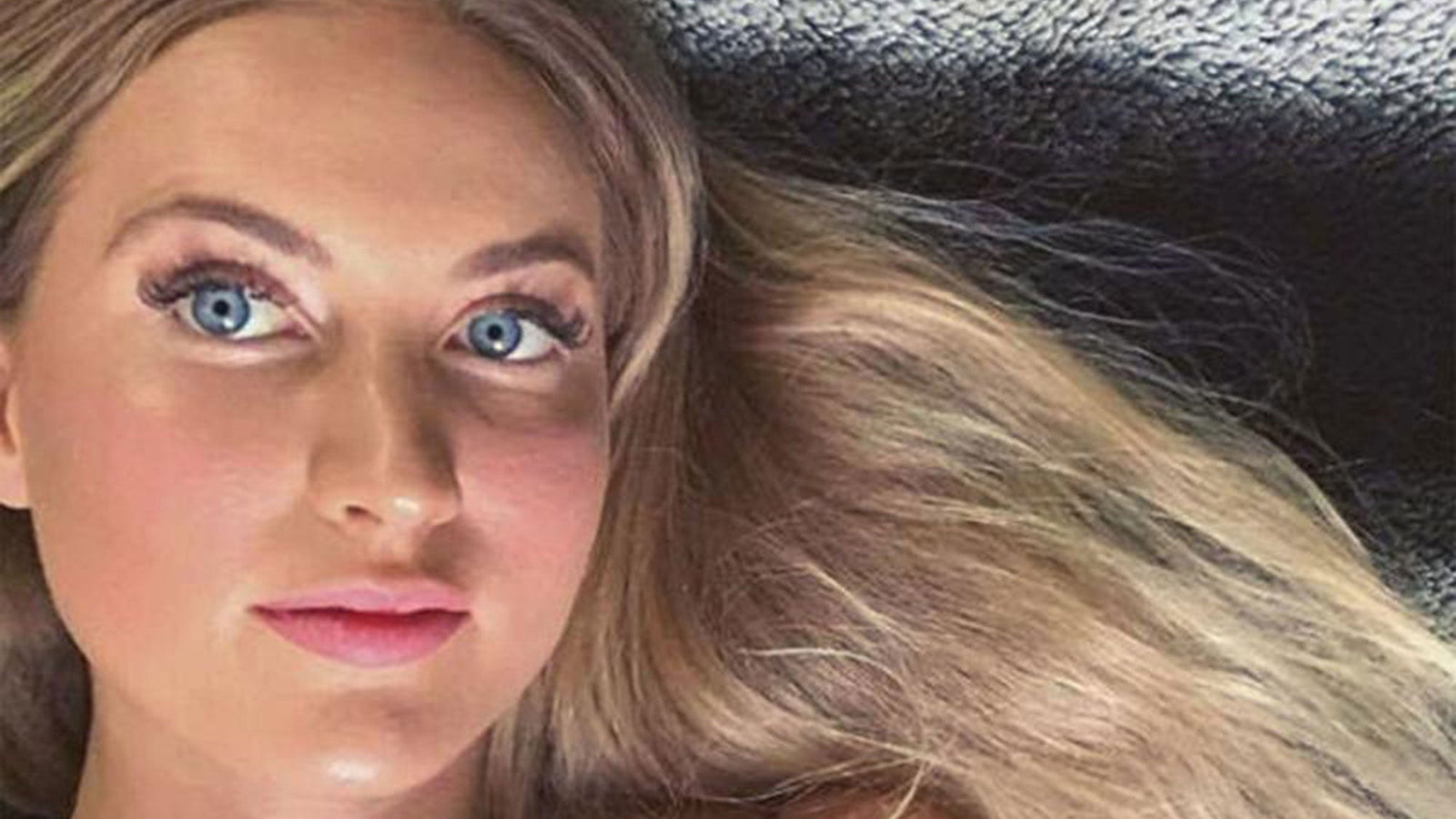 Eliza Hartigan: Before and After