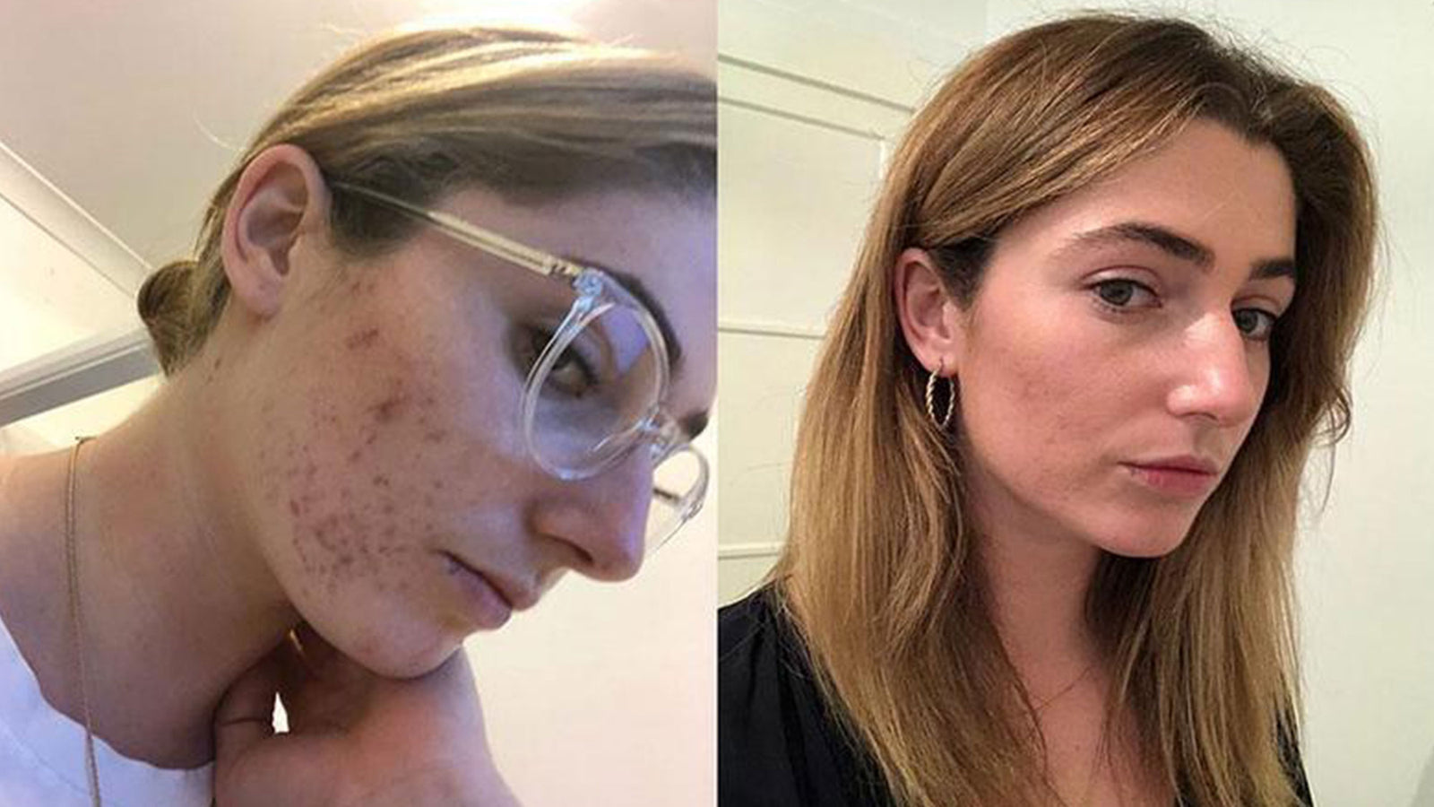 Ellie's Story: Before and After
