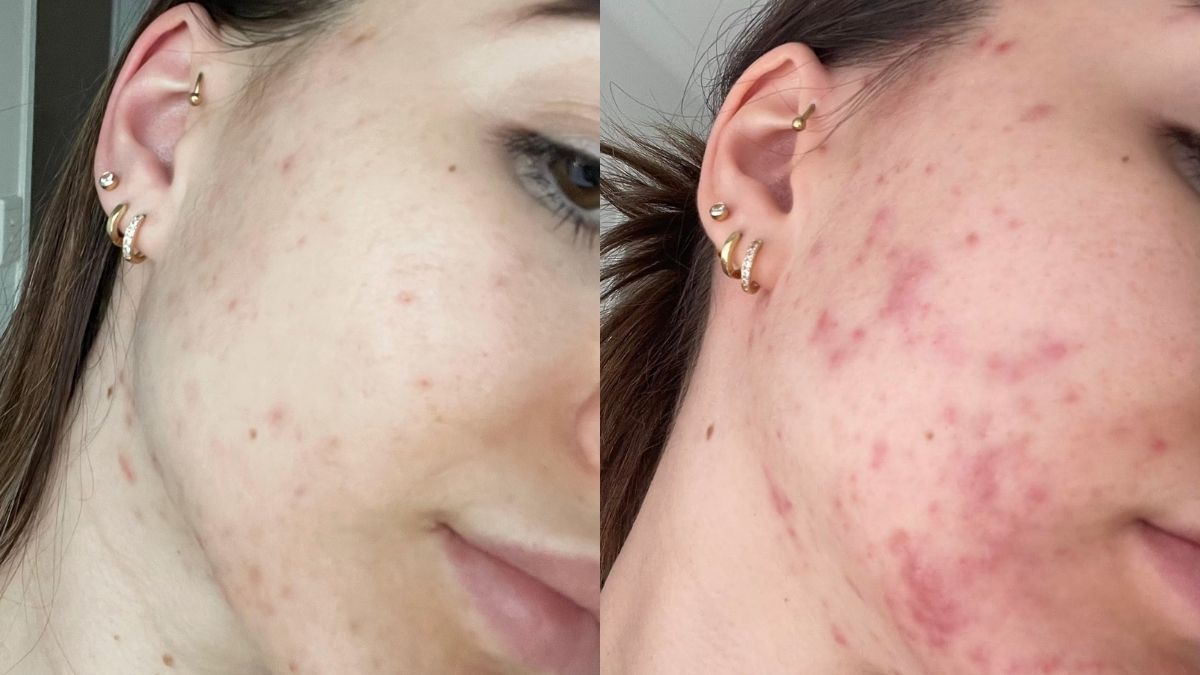 Before + After: Cloe's Story